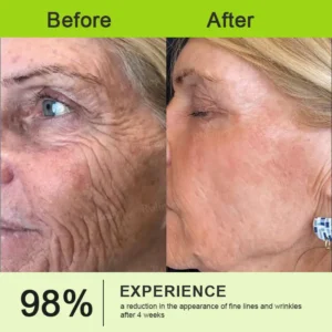 🎁🎉Made and Shipped from the USA ✅Rolimey® Botox & Vita-A Retinol Shot Wrinkle-Lift Tightening stick- Last Day Promotion 70% OFF🔥LAST DAY 70% OFF