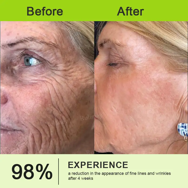 🎁🎉Made and Shipped from the USA ✅Rolimey® Botox & Vita-A Retinol Shot Wrinkle-Lift Tightening stick- Last Day Promotion 70% OFF🔥LAST DAY 70% OFF