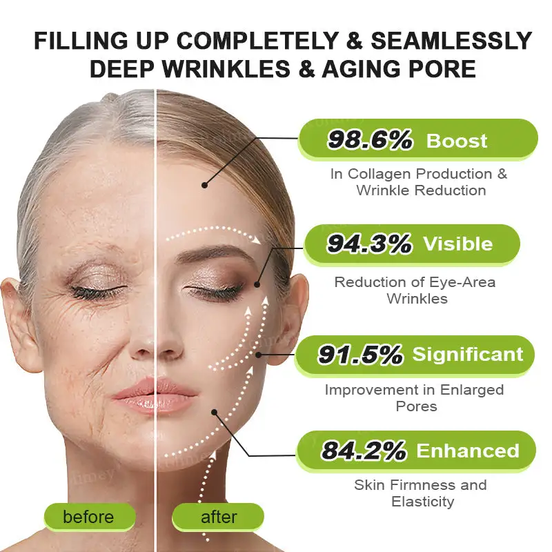🎁🎉Made and Shipped from the USA ✅Rolimey® Botox & Vita-A Retinol Shot Wrinkle-Lift Tightening stick- Last Day Promotion 70% OFF🔥LAST DAY 70% OFF