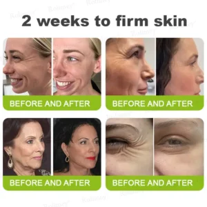 🎁🎉Made and Shipped from the USA ✅Rolimey® Botox & Vita-A Retinol Shot Wrinkle-Lift Tightening stick- Last Day Promotion 70% OFF🔥LAST DAY 70% OFF