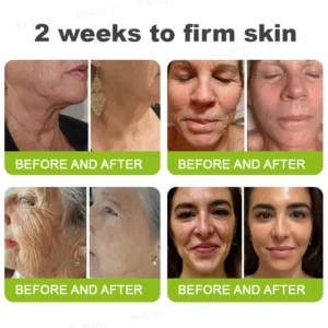 🎁🎉Made and Shipped from the USA ✅Rolimey® Botox & Vita-A Retinol Shot Wrinkle-Lift Tightening stick- Last Day Promotion 70% OFF🔥LAST DAY 70% OFF