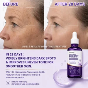 🗽Rolimey® Age Renewal Dark Spot Serum — Infused with 10% Niacinamide, Tranexamic Acid & Hyaluronic Acid for Brighter, Smoother-Looking Mature Skin