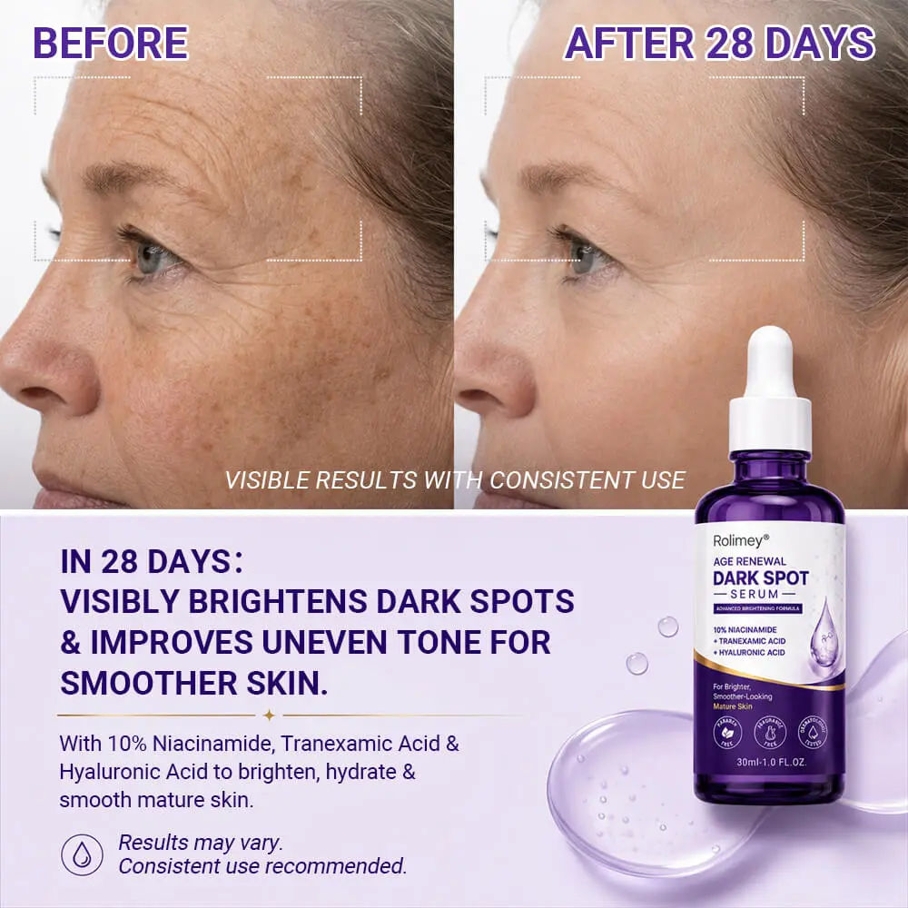 🗽Rolimey® Age Renewal Dark Spot Serum — Infused with 10% Niacinamide, Tranexamic Acid & Hyaluronic Acid for Brighter, Smoother-Looking Mature Skin