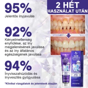 🌟Rolimey® VioCore Méhméreg Fogkezelő Fogkrém🔥