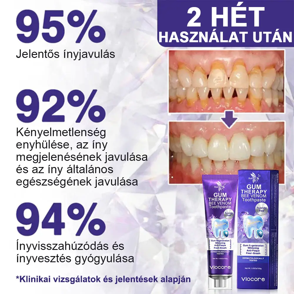 🌟Rolimey® VioCore Méhméreg Fogkezelő Fogkrém🔥